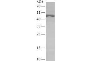 Western Blotting (WB) image for Ribosomal Protein S6 Kinase, 70kDa, Polypeptide 1 (RPS6KB1) (AA 51-300) protein (His-IF2DI Tag) (ABIN7124903) (RPS6KB1 Protein (AA 51-300) (His-IF2DI Tag))
