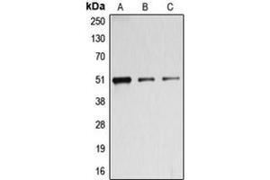 Western blot analysis of BAGE5 expression in HeLa (A), A549 (B), MOLT4 (C) whole cell lysates.