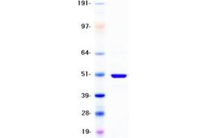 Western Blotting (WB) image for Cytochrome P450, Family 2, Subfamily D, Polypeptide 6 (CYP2D6) protein (DYKDDDDK Tag) (ABIN2712769)