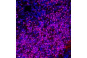 Immunofluorescence of paraffin embedded rat thymus using TCF7 (ABIN7075952) at dilution of 1:600 (400x lens) (TCF7 抗体)