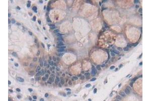 Immunohistochemistry (IHC) image for anti-ATPase, H+ Transporting, Lysosomal Accessory Protein 2 (ATP6AP2) (AA 17-302) antibody (ABIN7439744)