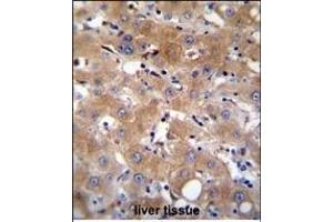 Immunohistochemistry (Paraffin-embedded Sections) (IHC (p)) image for anti-Transient Receptor Potential Cation Channel, Subfamily M, Member 8 (TRPM8) (AA 263-292) antibody (ABIN655714)