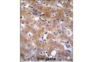 TR Antibody (Center) (ABIN655714 and ABIN2845164) immunohistochemistry analysis in formalin fixed and paraffin embedded human liver tissue followed by peroxidase conjugation of the secondary antibody and DAB staining. (TRPM8 抗体  (AA 263-292))