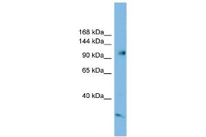 WB Suggested Anti-SMEK1 Antibody Titration: 0. (SMEK1 抗体  (Middle Region))