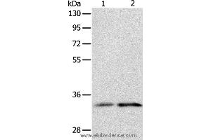 Western blot analysis of Human fetal kidney and intestine tissue, using IL1RL1 Polyclonal Antibody at dilution of 1:1100 (IL1RL1 抗体)