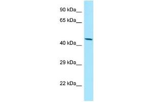 WB Suggested Anti-MMP28 Antibody Titration: 1. (MMP28 抗体  (C-Term))