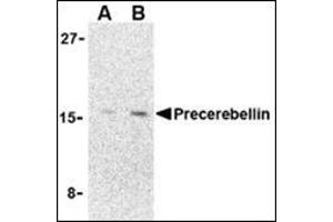 Western blot analysis of precerebellin in 293 cell lysate with precerebellin AP30690PU-N at (A) 2 and (B) 4 μg/ml. (CBLN1 抗体  (C-Term))