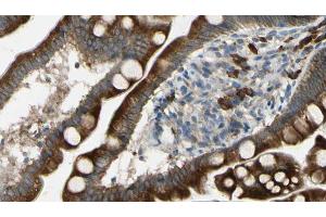 ABIN6267436 at 1/100 staining Mouse intestine tissue by IHC-P. (CBL 抗体  (pTyr674))