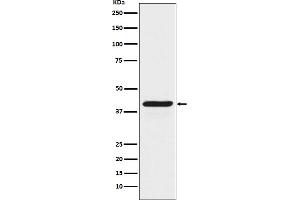 Western blot analysis of INDO expression in HeLa cell lysate treated with IFN gamma.