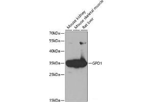 Western blot analysis of extracts of various cell lines using GPD1 Polyclonal Antibody at dilution of 1:1000. (GPD1 抗体)