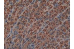DAB staining on IHC-P; Samples: Rat Stomach Tissue (MIA 抗体  (AA 36-127))