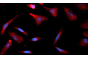 Immunofluorescence (IF) image for anti-CNDP Dipeptidase 2 (Metallopeptidase M20 Family) (CNDP2) (AA 1-475) antibody (APC) (ABIN5565179) (CNDP2 抗体  (AA 1-475) (APC))