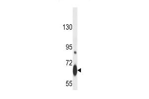 Western Blotting (WB) image for anti-V-Myb Myeloblastosis Viral Oncogene Homolog (Avian) (MYB) (AA 506-534), (Sumoylation Site) antibody (ABIN389068)