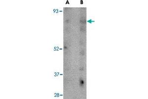 Western blot analysis of SCARB2 in human skeletal muscle tissue lysate with SCARB2 polyclonal antibody  at (A) 1 and (B) 2 ug/mL . (SCARB2 抗体  (C-Term))