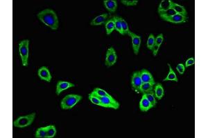 Immunofluorescent analysis of HepG2 cells using ABIN7173163 at dilution of 1:100 and Alexa Fluor 488-congugated AffiniPure Goat Anti-Rabbit IgG(H+L) (C2CD2L 抗体  (AA 42-87))