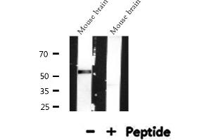 Western blot analysis of MeCP2 expression in Mouse brain lysate (MECP2 抗体  (N-Term))