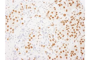 Immunohistochemistry (IHC) image for anti-RNA-binding protein Raly (RALY) (AA 150-200) antibody (ABIN7453509)