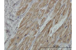 Immunoperoxidase of monoclonal antibody to PDHB on formalin-fixed paraffin-embedded human heart. (PDHB 抗体  (AA 250-359))