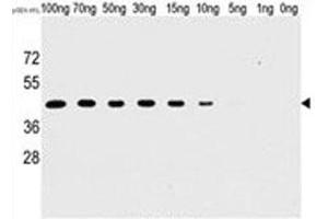 Western blot analysis of H1L antibody and recombinant H1L protein. (Tyr/ser Protein Phosphatase 抗体)