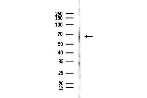 anti-Cysteine-serine-Rich Nuclear Protein 1 (CSRNP1) (C-Term) antibody