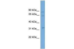 WB Suggested Anti-CAPN11 Antibody Titration: 0. (CAPN11 抗体  (N-Term))