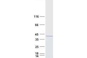 Western Blotting (WB) image for Protein Arginine Methyltransferase 6 (PRMT6) protein (Myc-DYKDDDDK Tag) (ABIN2729674)