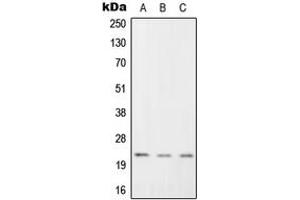 Western blot analysis of RGS1 expression in K562 (A), Raw264. (RGS1 抗体  (Center))