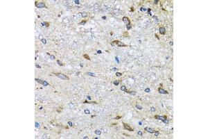 Immunohistochemistry of paraffin-embedded mouse spinal cord using BLZF1 antibody (ABIN5973830) at dilution of 1/100 (40x lens). (BLZF1 抗体)