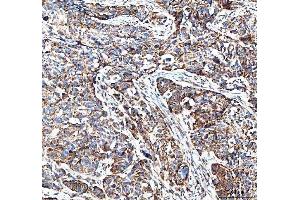 IHC analysis of MUT using anti-MUT antibody (ABIN4886676). (MUT 抗体  (N-Term))