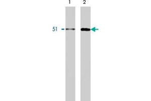 Western blot using HNRNPK monoclonal antibody, clone F45 P9 C7  on Calu-6 (1) and HT-29 (2) cell lysates. (HNRNPK 抗体  (C-Term))