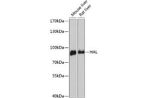 Western blot analysis of extracts of various cell lines, using HAL antibody (ABIN6130467, ABIN6141593, ABIN6141594 and ABIN6216851) at 1:3000 dilution.
