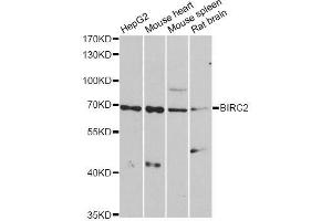 Western blot analysis of extracts of various cell lines, using BIRC2 antibody. (BIRC2 抗体  (AA 1-300))