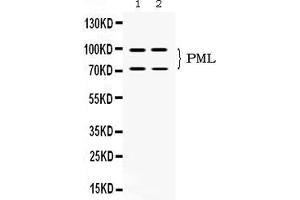 Western blot analysis of PML Protein expression in SW620 whole cell lysates ( Lane 1) and U2OS whole cell lysates ( Lane 2). (PML 抗体  (N-Term))
