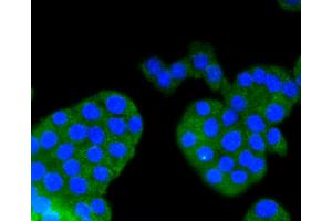 Immunofluorescence analysis of PC-12 cells using ARRB1 antibody (ABIN4903044). (beta Arrestin 1 抗体)