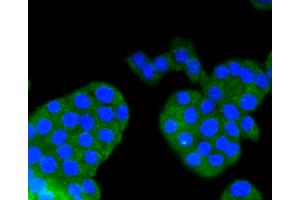 Immunofluorescence analysis of PC-12 cells using ARRB1 antibody (ABIN4903044). (beta Arrestin 1 抗体)