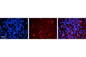 Rabbit Anti-FBXO9 Antibody     Formalin Fixed Paraffin Embedded Tissue: Human Pineal Tissue  Observed Staining: Cytoplasmic in cell bodies and processes of pinealocytes  Primary Antibody Concentration: 1:100  Other Working Concentrations: 1/600  Secondary Antibody: Donkey anti-Rabbit-Cy3  Secondary Antibody Concentration: 1:200  Magnification: 20X  Exposure Time: 0. (FBXO9 抗体  (Middle Region))