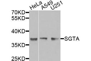 Western blot analysis of extracts of various cells, using SGTA antibody. (SGTA 抗体)