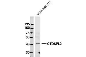 CTDSPL2 antibody  (AA 11-110)