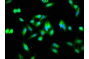 Immunofluorescence staining of Hela cells with ABIN7161777 at 1:133, counter-stained with DAPI. (NFKB2 抗体  (AA 263-439))
