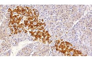 Immunohistochemistry (IHC) image for anti-Clusterin (CLU) (AA 228-449) antibody (ABIN7433222)