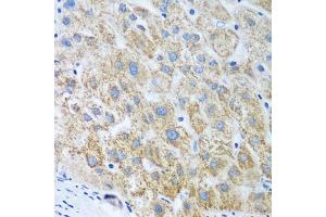 Immunohistochemistry of paraffin-embedded human liver using UBE2U antibody (ABIN5974574) at dilution of 1/100 (40x lens). (UBE2U 抗体)