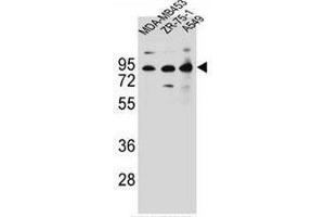 CTTNBP2NL Antibody (N-term) western blot analysis in MDA-MB453,ZR-75-1,A549 cell line lysates (35µg/lane). (CTTNBP2NL 抗体  (N-Term))