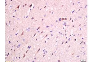 Formalin-fixed and paraffin embedded rat brain labeled with Anti-FAM134B Polyclonal Antibody, Unconjugated  at 1:200 followed by conjugation to the secondary antibody and DAB staining (FAM134B 抗体  (AA 210-310))