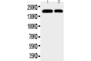 Anti-CD11b antibody, All Western blottingAll lanes: Anti-ITGAM at 0. (CD11b 抗体  (N-Term))