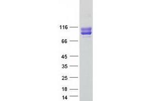 Western Blotting (WB) image for Melanoma Cell Adhesion Molecule (MCAM) protein (Myc-DYKDDDDK Tag) (ABIN2713428)