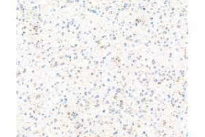 Immunohistochemistry (IHC) image for anti-Doublecortin (DCX) (AA 200-250) antibody (ABIN7453969) (Recombinant Doublecortin 抗体  (AA 200-250))