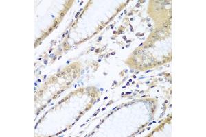 Immunohistochemistry of paraffin-embedded human stomach using WDR48 antibody (ABIN5974731) at dilution of 1/100 (40x lens). (WDR48 抗体)