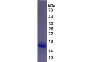 SDS-PAGE of Protein Standard from the Kit  (Highly purified E. (S100A6 ELISA 试剂盒)