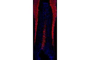 human scalp hair (courtesy of L. (KRT16 抗体)