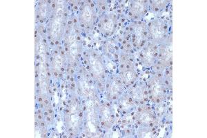 Immunohistochemistry of paraffin-embedded mouse kidney using A Rabbit mAb (ABIN7265387) at dilution of 1:100 (40x lens). (BAF53A 抗体)